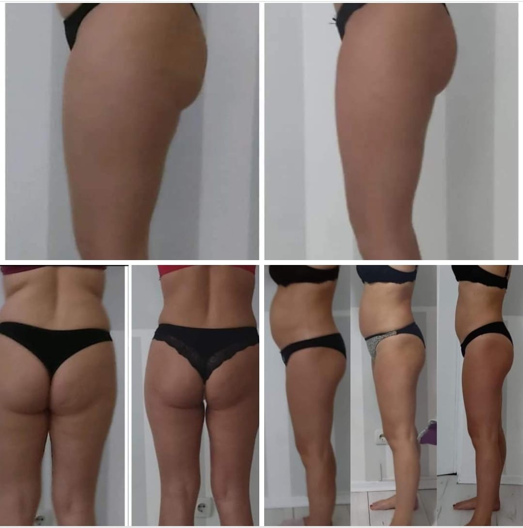 Čarobni dodir #osijek