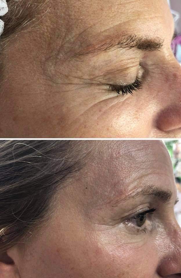 Antiage beauty room Lady Goga #zagreb Tretman lica