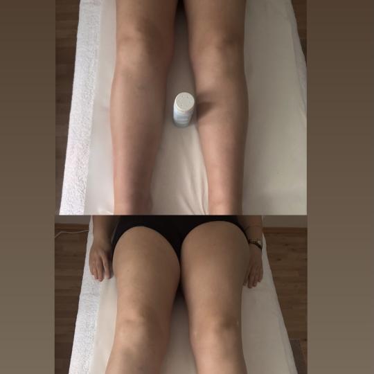 KK Body Therapy #zagreb Tretmani tijela Ručna limfna drenaža Ručna limfna drenaža 60 minuta