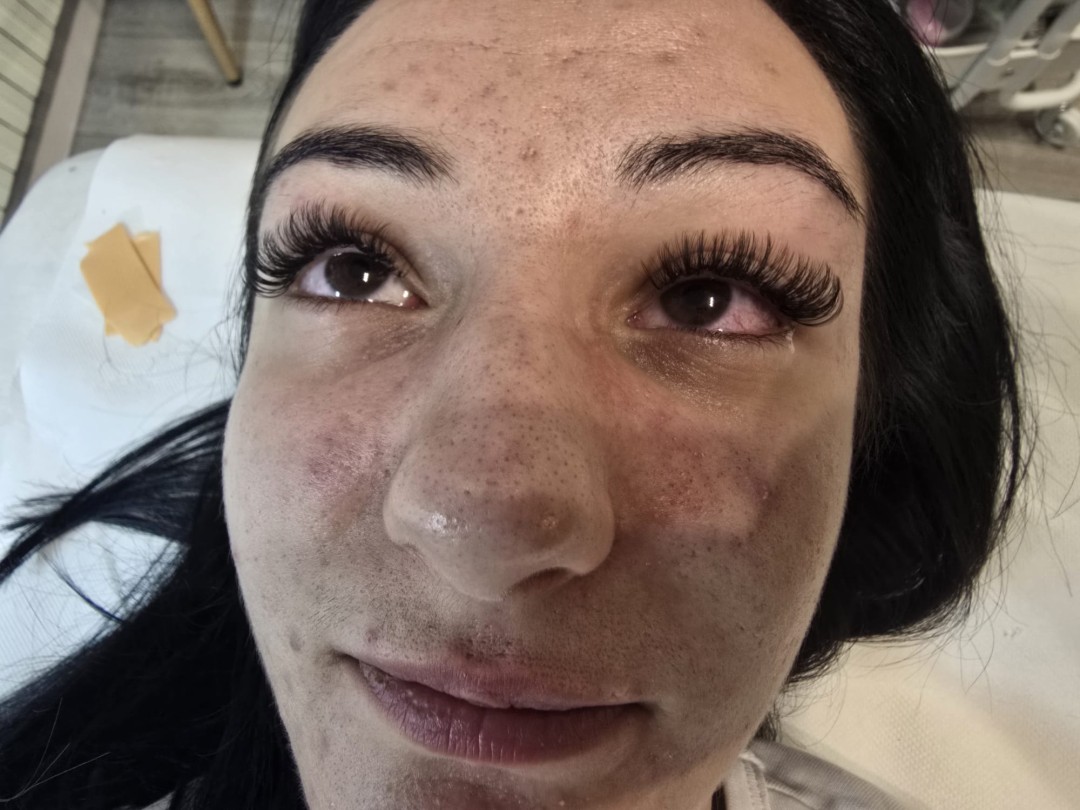 Glow Differently #zagreb Nadogradnja trepavica Ugradnja volumenskih trepavica