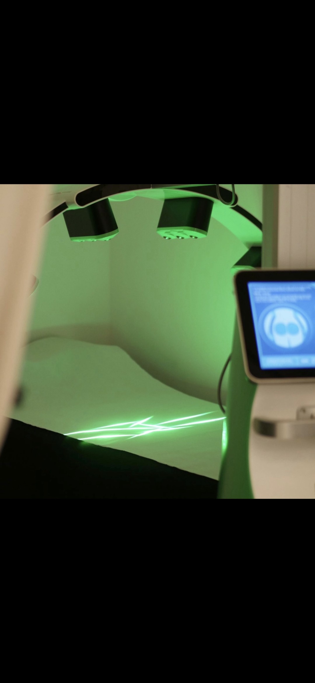 Val beauté #zagreb Tretmani tijela Green laser - paket od 4 tretmana + 1 tretman gratis