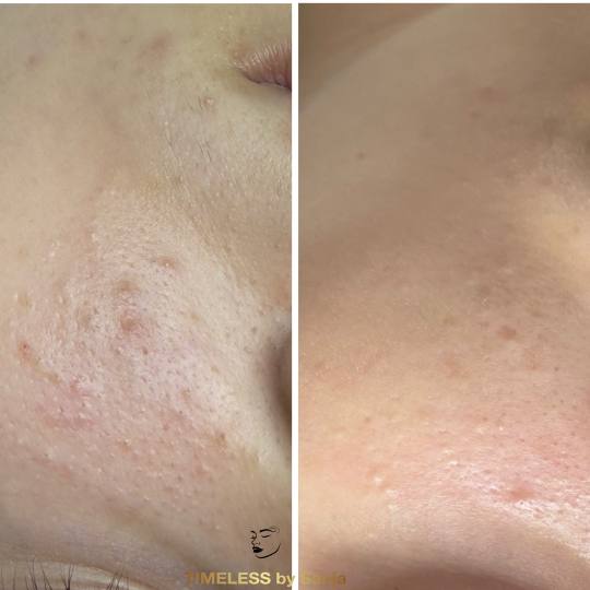 Timeless by Sanja usluga