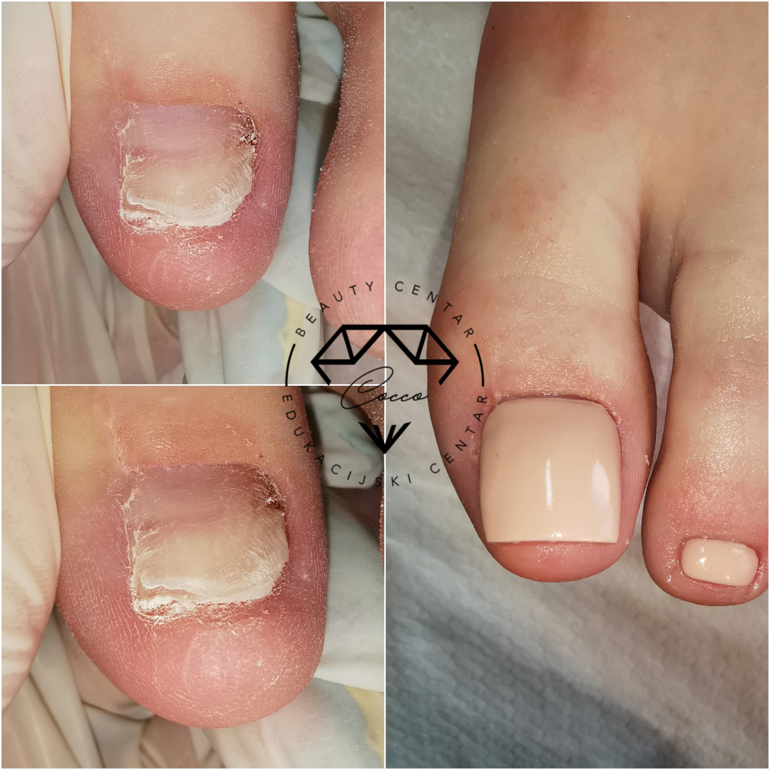 Beauty Centar By Cocco #viskovo Estetska pedikura