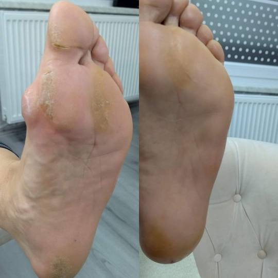 Boba Nail Bar #zagreb Estetska pedikura Ruska pedikura