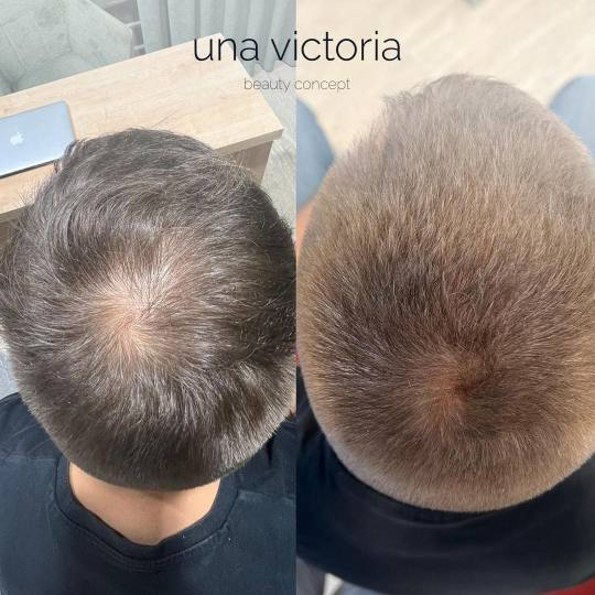 Una Victoria beauty concept usluga