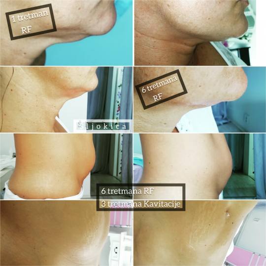 Salon Ljepote Šljokica #zagreb