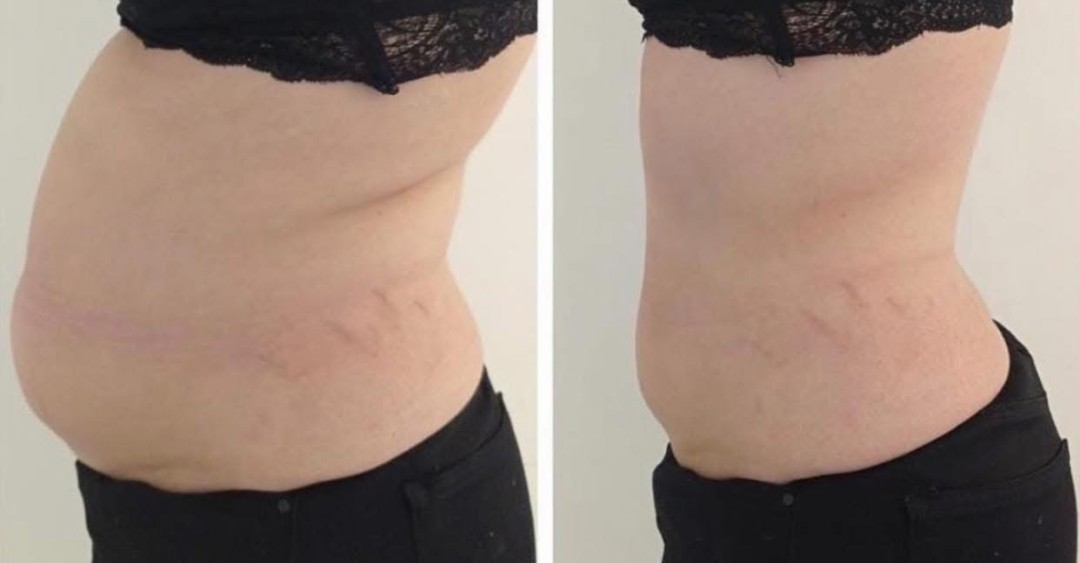 Estetix centar #zagreb