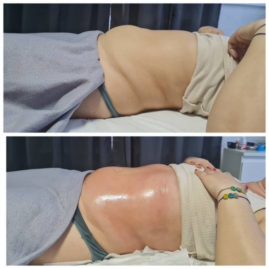 Glitter and glam #zagreb Tretmani tijela Limfno modelovanje - jedna zona Limfno modeliranje – 
