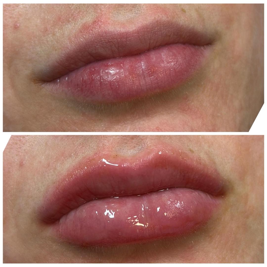 Guardian Beauty House Academy #zagreb Tretman lica Hydra gloss usne