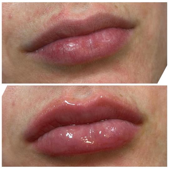 Guardian Beauty House Academy #zagreb Tretman lica Hydra gloss usne Vizualno punije, nahranjene i bl