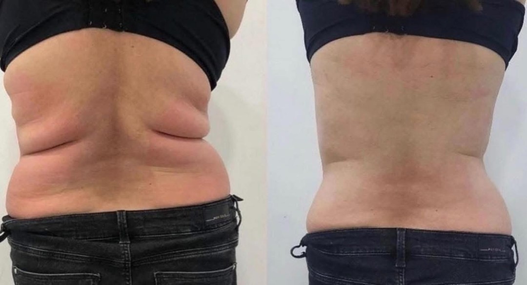 Estetix centar #zagreb