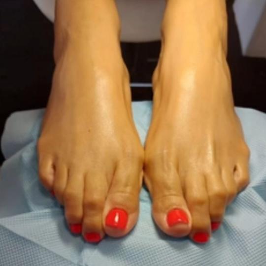 Josea beauty studio #zagreb Medicinska pedikura Kraljevski tretman-spa tretman+piling+masaza stopala