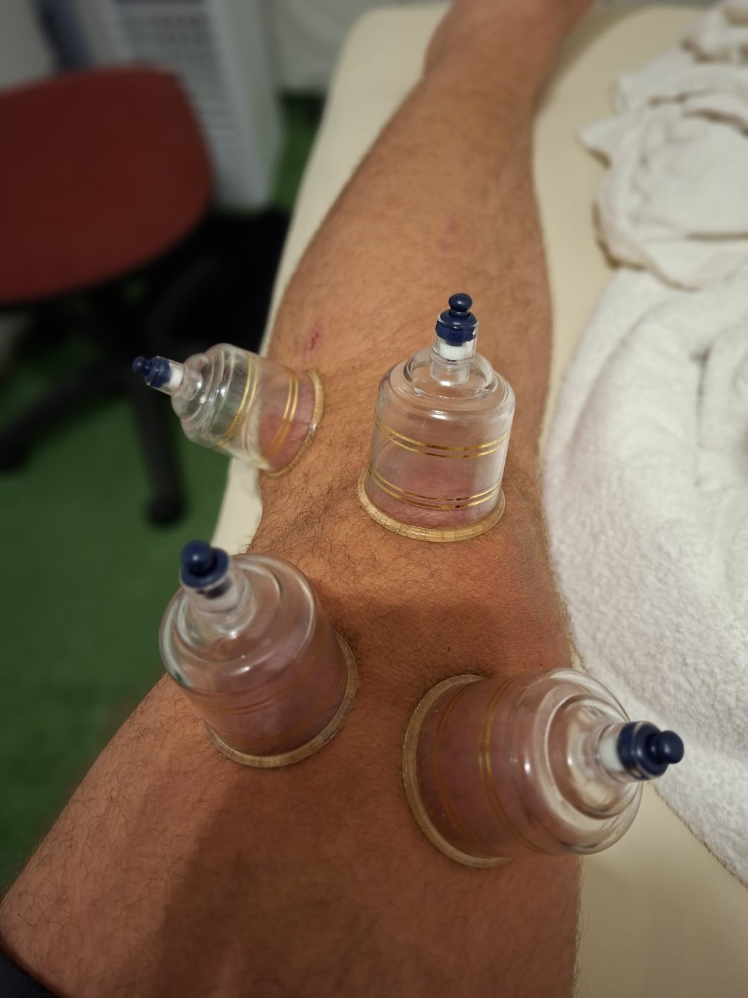 S M Beauty Bloom #zadar Opća masaža Cupping masaža