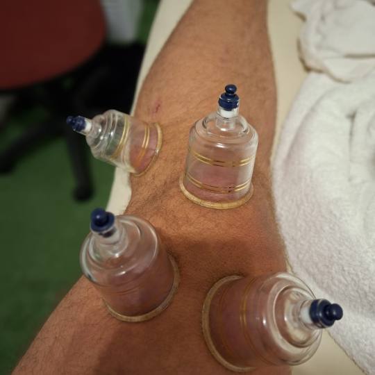 S M Beauty Bloom #zadar Opća masaža Cupping masaža