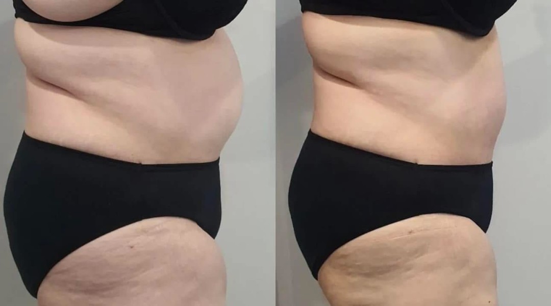 Estetix centar #zagreb