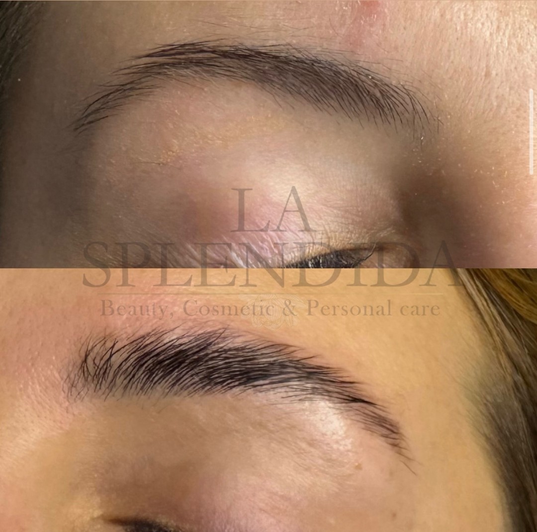 La Splendida #velika-gorica Obrve Brow lift