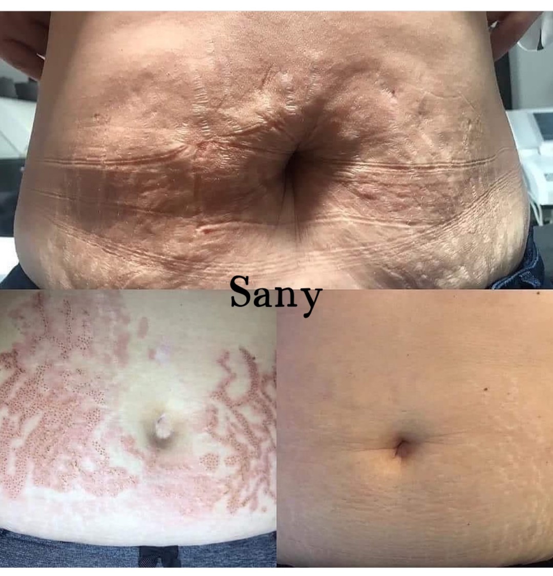 Sany Nails & Cosmetics #zagreb Tretman lica