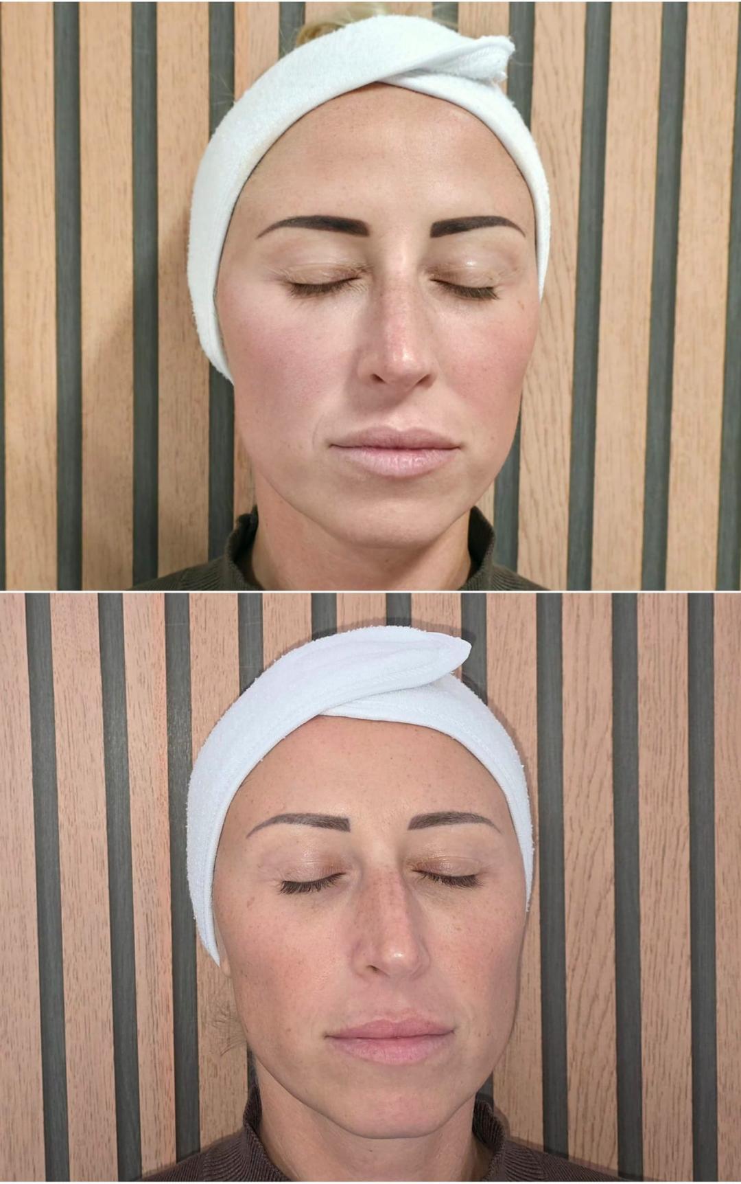 S M Beauty Bloom #zadar Tretman lica BB Glow Hollywood - tretman lica