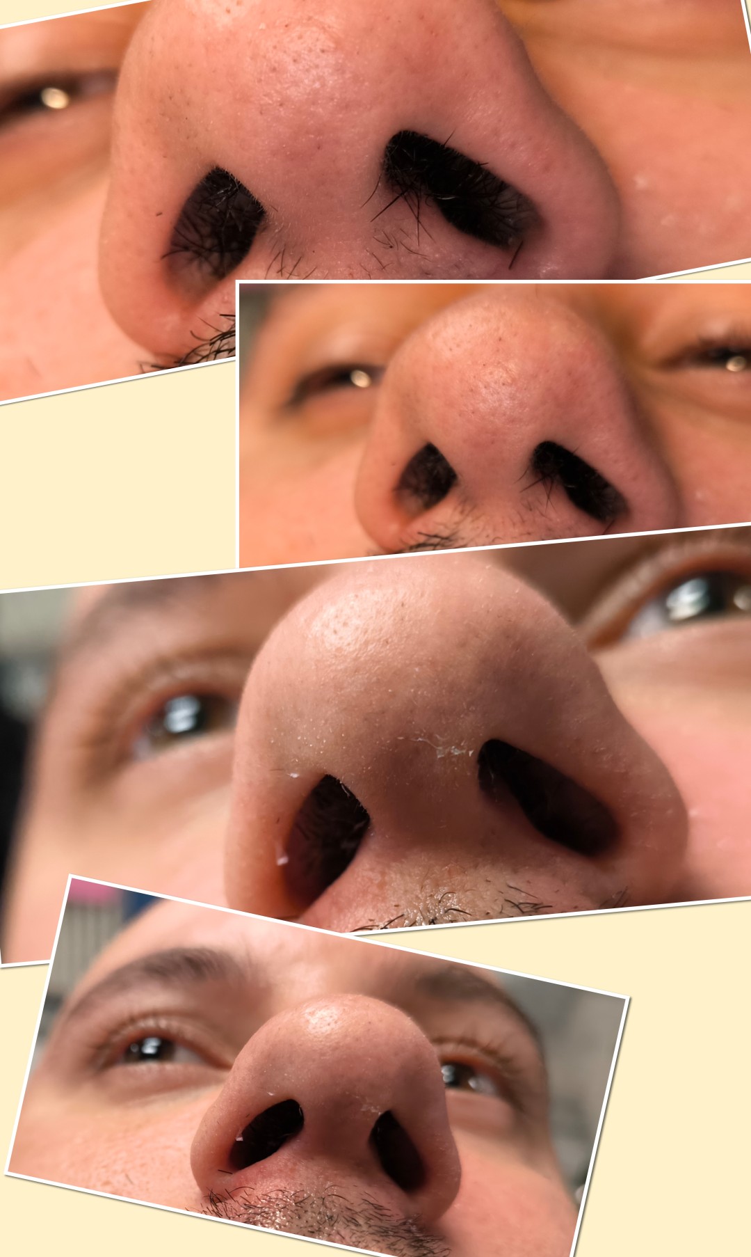 Mare #zagreb Obrve DEPILACIJA DLAKA U NOSNICAMA