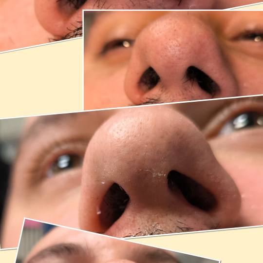 Mare #zagreb Obrve DEPILACIJA DLAKA U NOSNICAMA Vrlo praktično rješenje za sve koji se žele na du