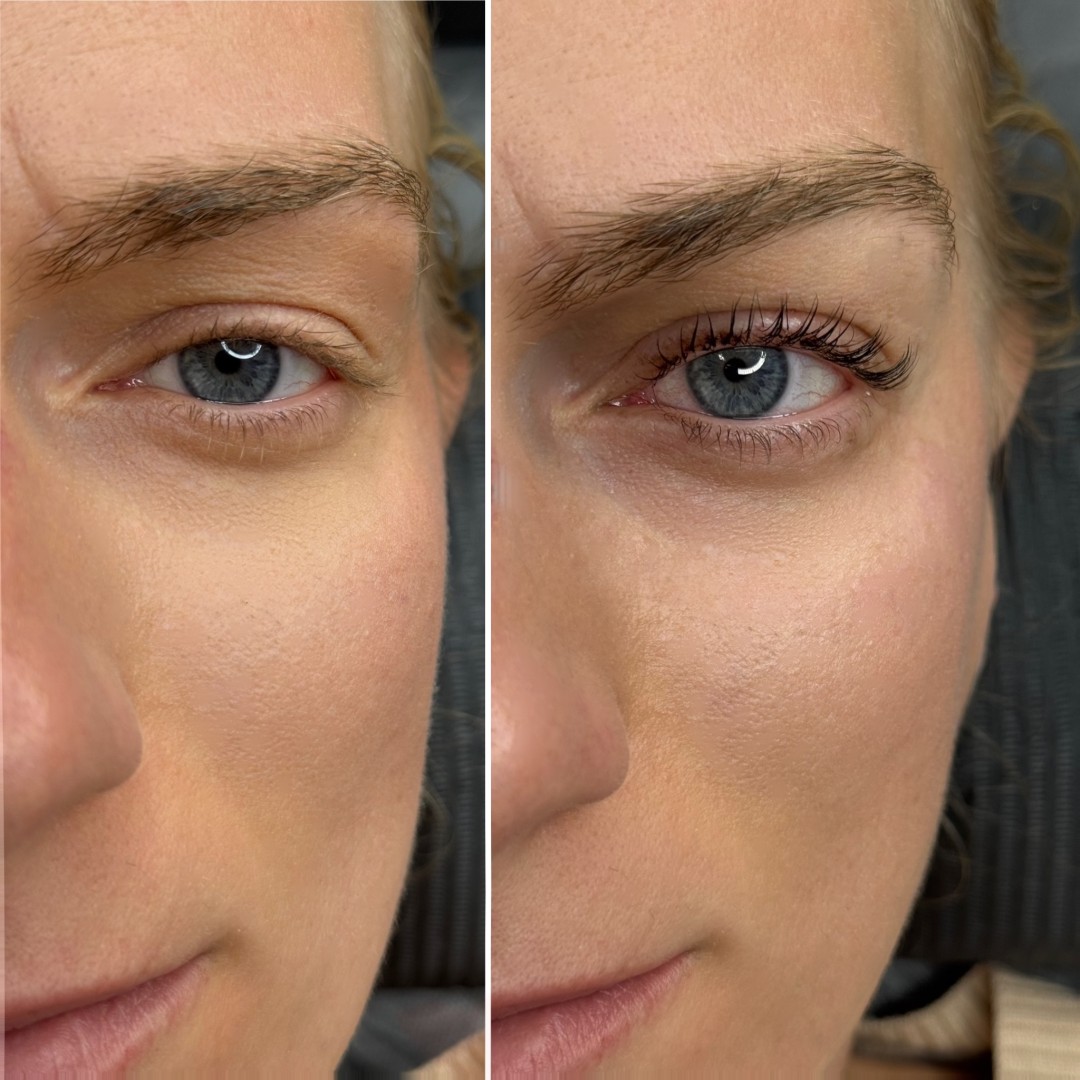 Lash lift + bojanje trepavica - Anova Aesthetics, Zagreb Trepavice Lice Trepavice, Zagreb, Trešnjevka – jug
