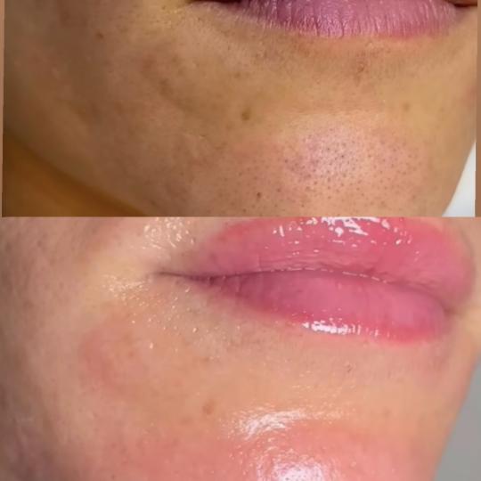 Perfect body beauty bar usluga