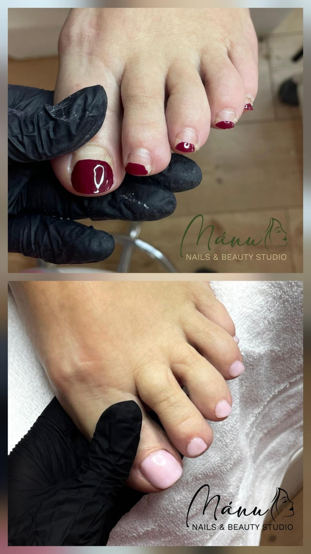 Medicinska pedikura + trajni lak - Nails & Beauty Studio Mánu, Zagreb Medicinska pedikura Nokti Medicinska pedikura, Zagreb, Novi Zagreb – istok