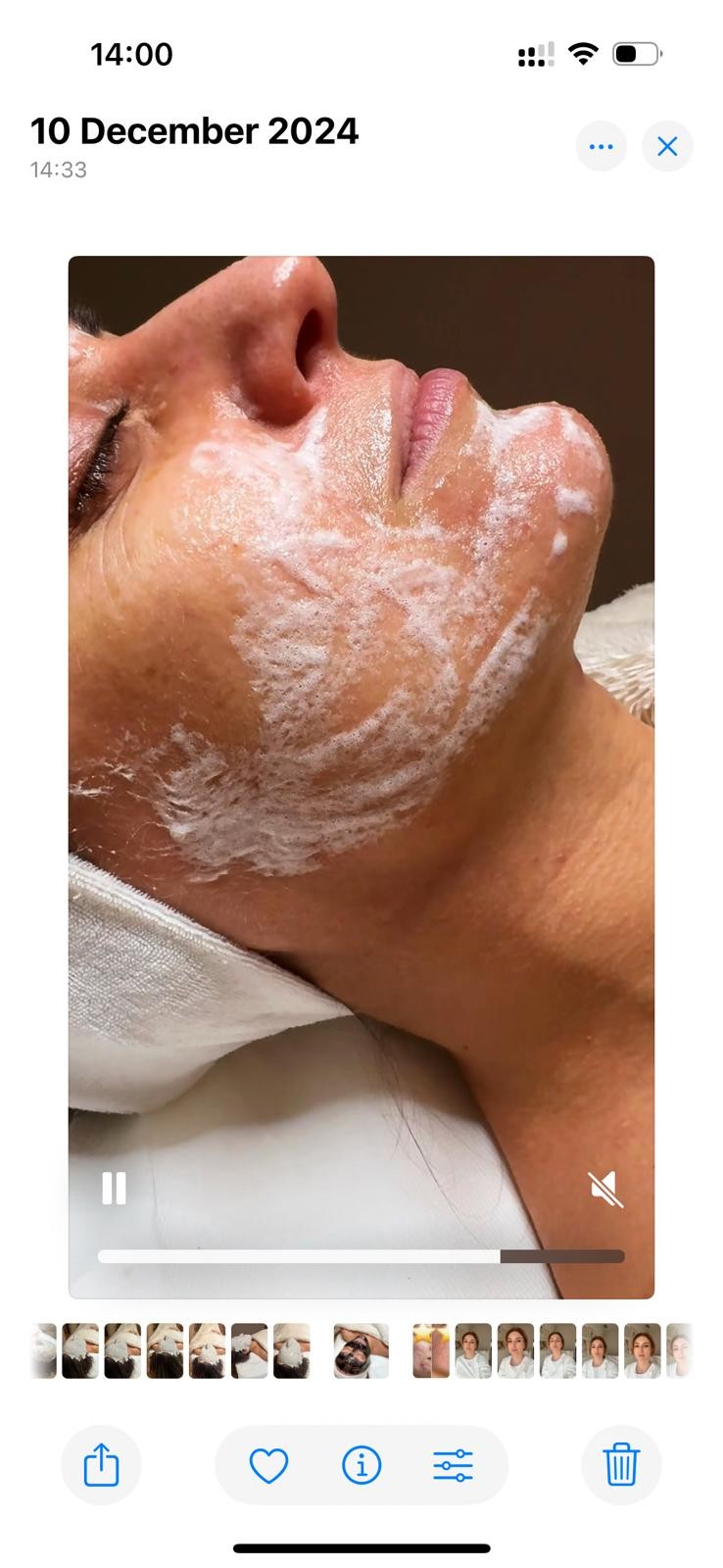 Silk skin #zagreb Tretman lica Lift and Glow Intense