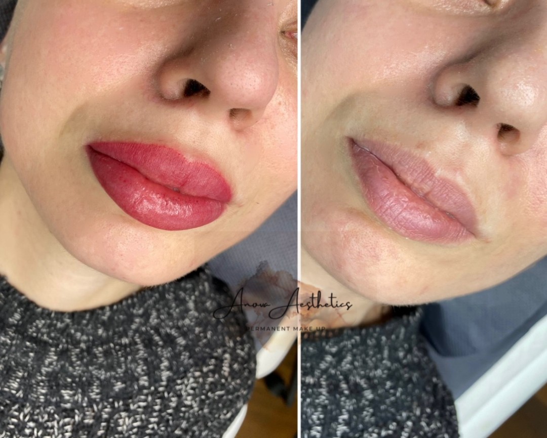 Anova Aesthetics #zagreb Trajna šminka Trajna šminka - usne