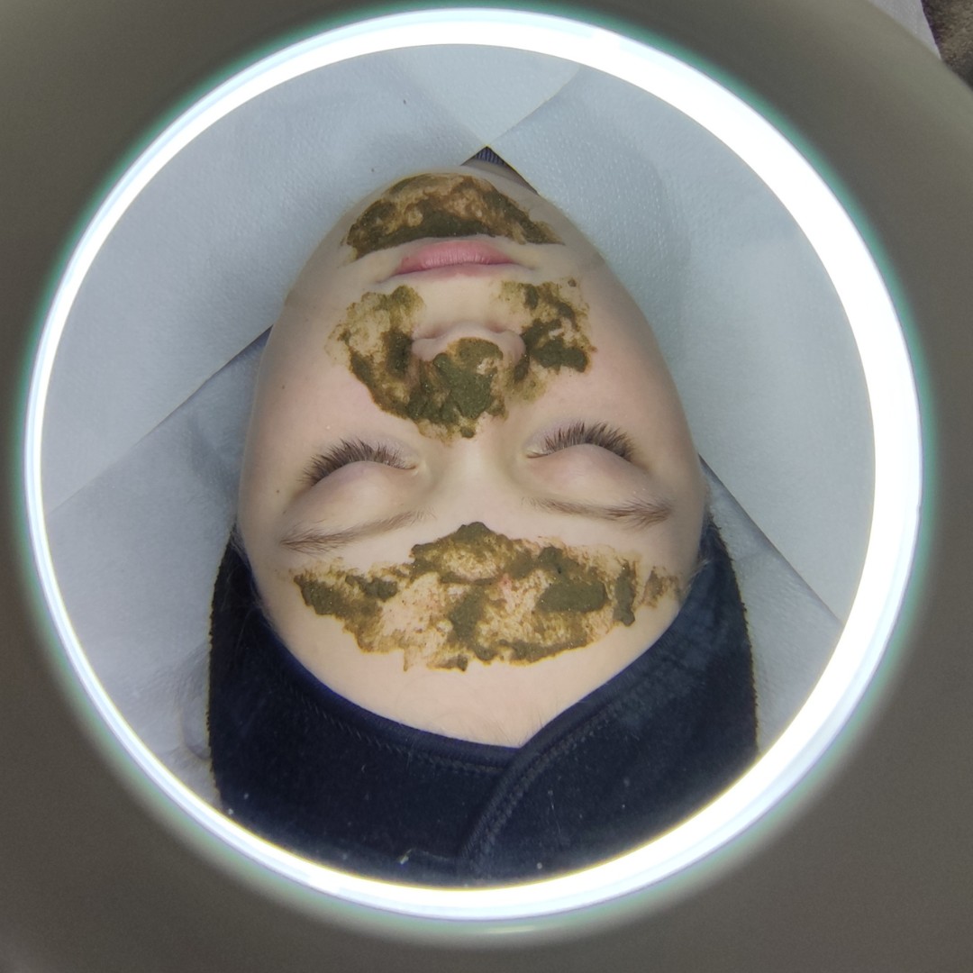 Aromavita Bella Donna #varazdin Tretman lica Fitopiling