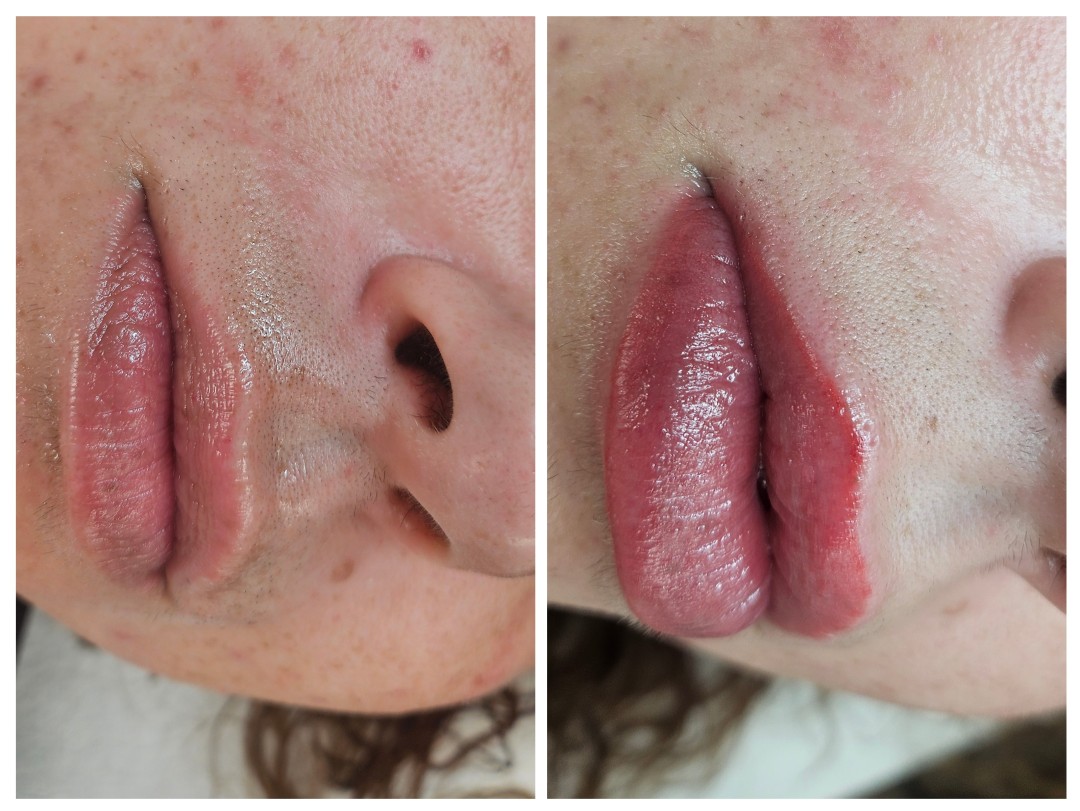 Trajna šminka - usne - lip blush - Cosmoderm & Centar Estetica, Zagreb Trajna šminka Lice Trajna šminka, Zagreb, Trnje