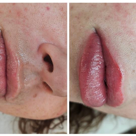 Cosmoderm & Centar Estetica usluga