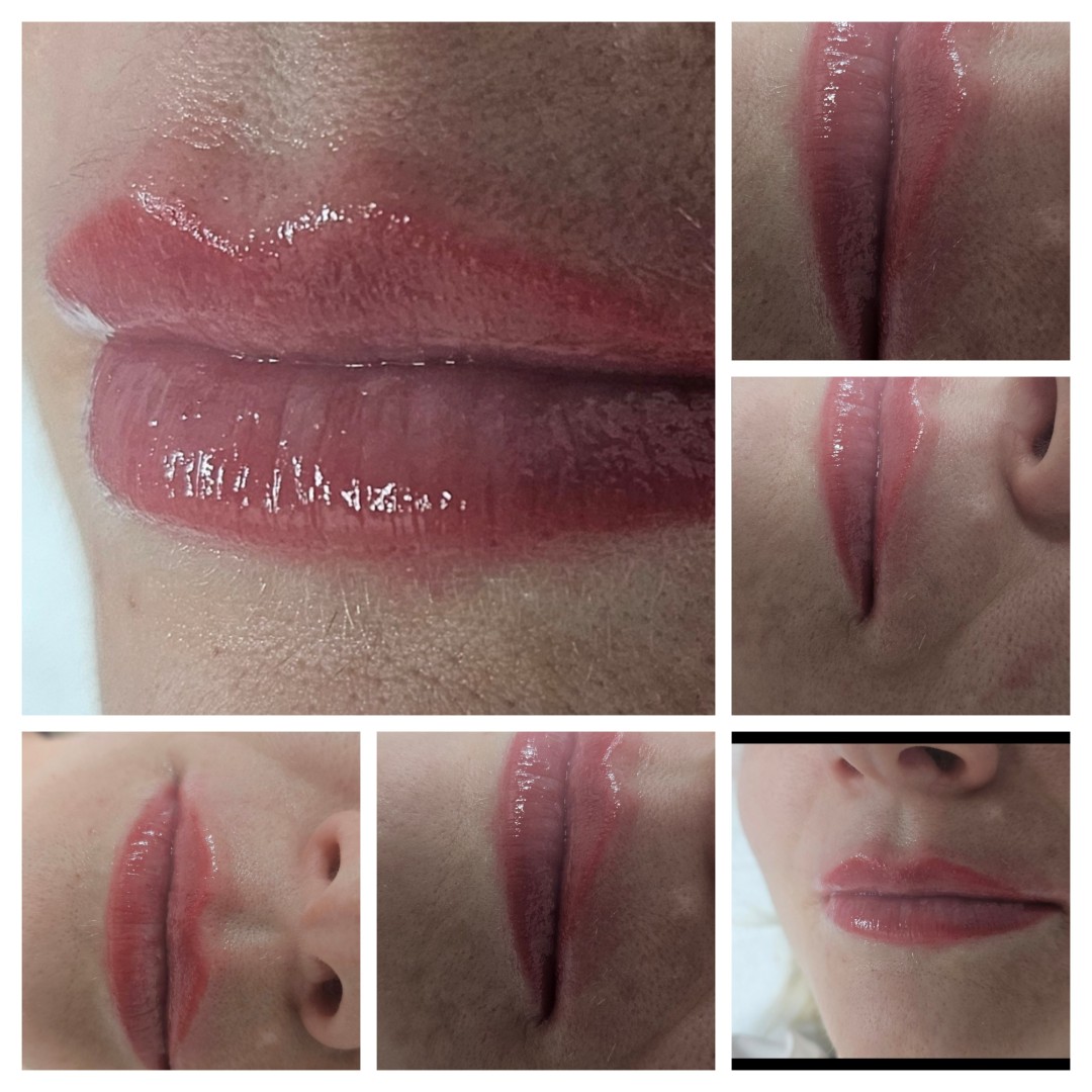 Cosmoderm & Centar Estetica #zagreb Trajna šminka Trajna šminka - usne - lip blush