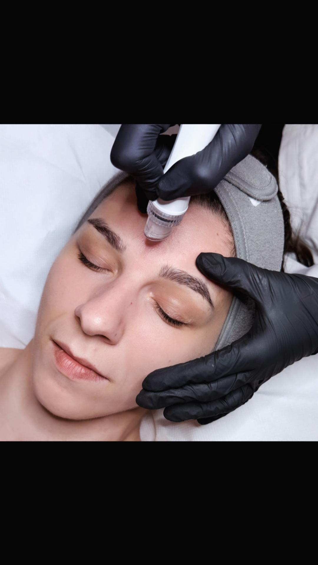 Hydrafacial tretman lica + vrata - Luxelumíe, Zagreb Tretman lica Lice Tretman lica, Zagreb, Maksimir