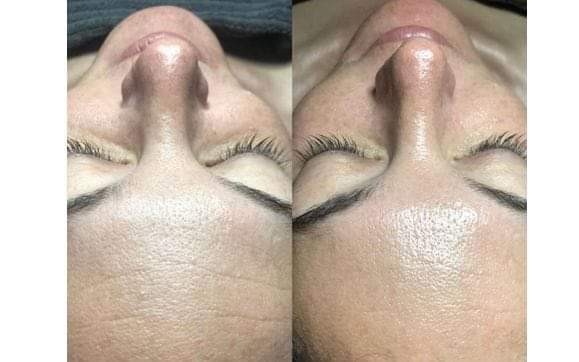 Antiage beauty room Lady Goga #zagreb Tretman lica