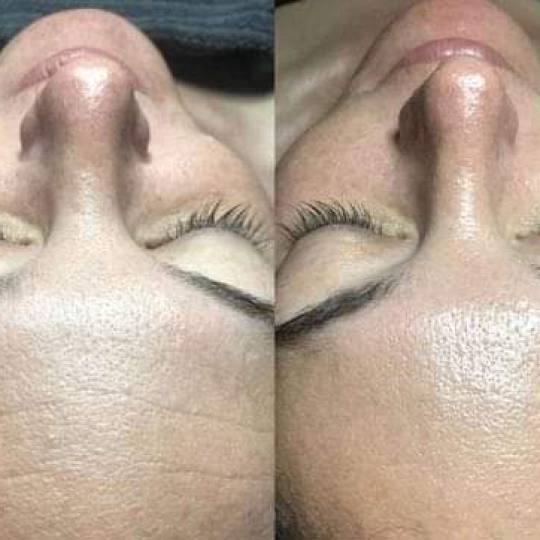 Antiage beauty room Lady Goga #zagreb Tretman lica