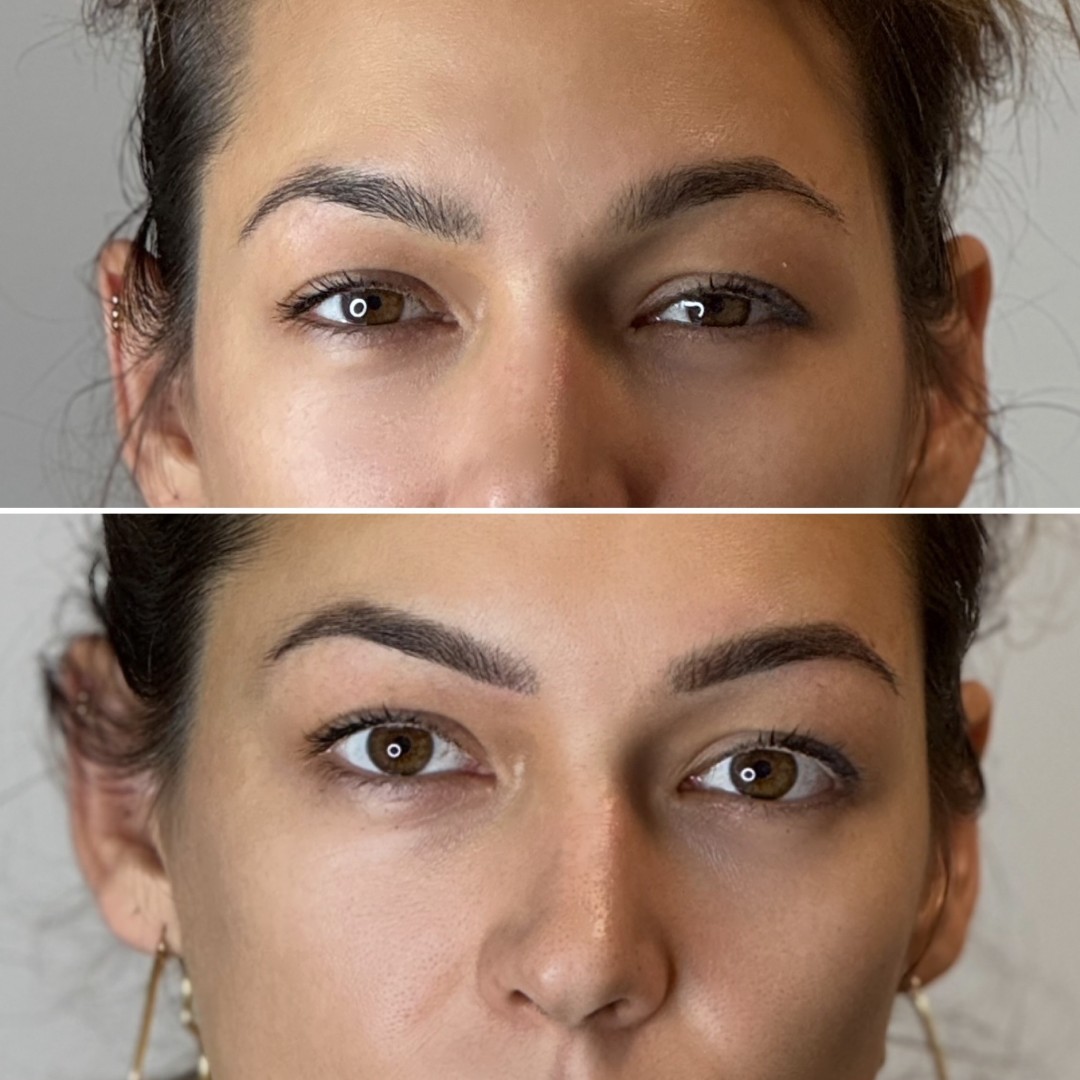 Anova Aesthetics #zagreb Trajna šminka Puder obrve