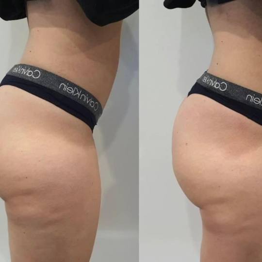 Estetix centar usluga