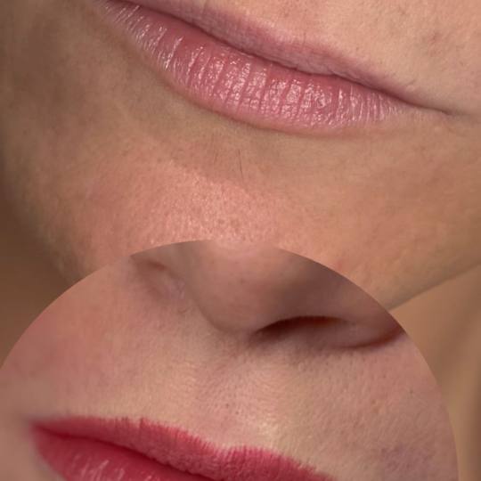 MOELL beauty #zagreb Trajna šminka Mikropigmentacija usana /Lip blush