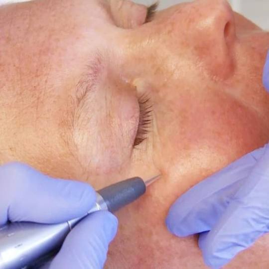 Antiage beauty room Lady Goga #zagreb Tretman lica