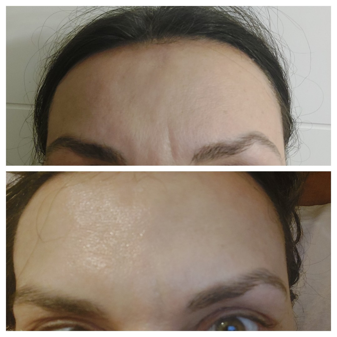 Antiage beauty room Lady Goga #zagreb Tretman lica