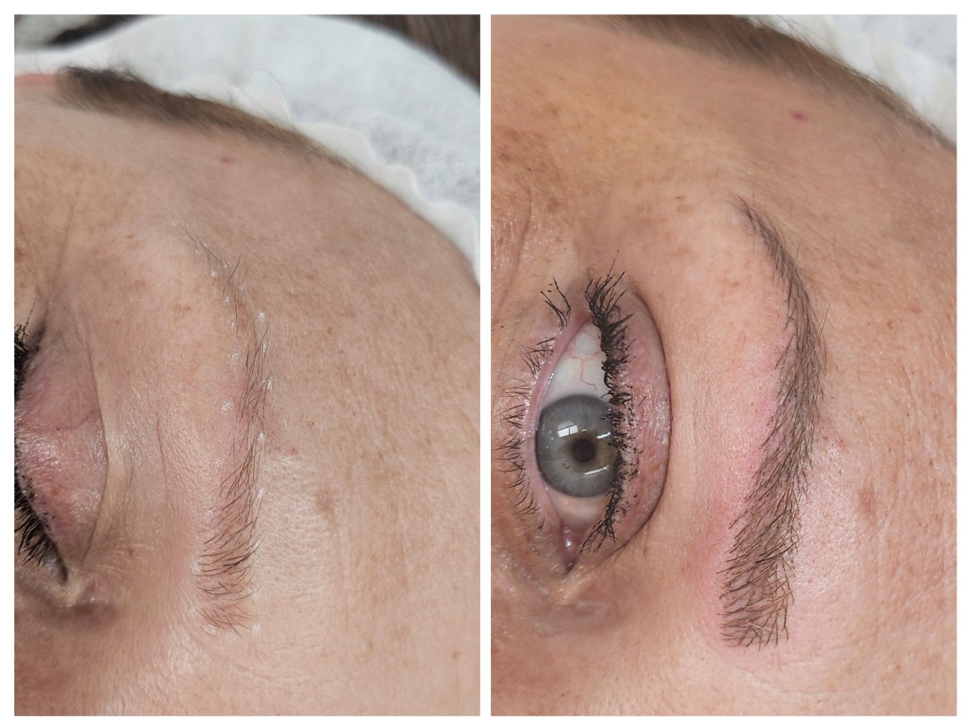 Cosmoderm & Centar Estetica #zagreb Trajna šminka Trajna šminka - iscrtavanje dlačica (hiper realistične obrve)