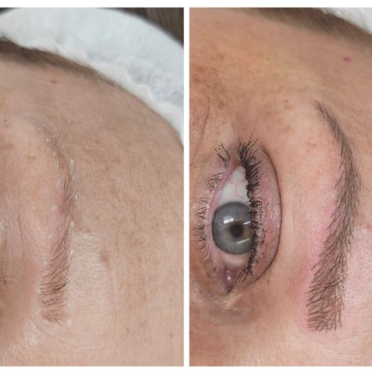 Cosmoderm & Centar Estetica #zagreb Trajna šminka Trajna šminka - iscrtavanje dlačica (hiper real