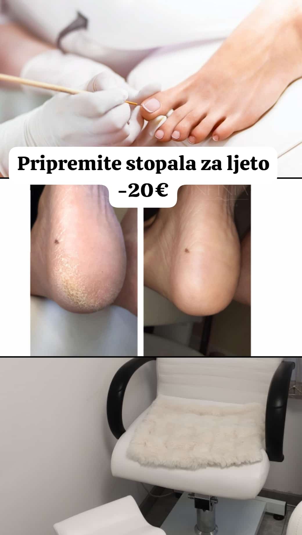 Estetska pedikura - SolGabi, Zlatar Estetska pedikura Nokti Estetska pedikura, Zlatar, Centar