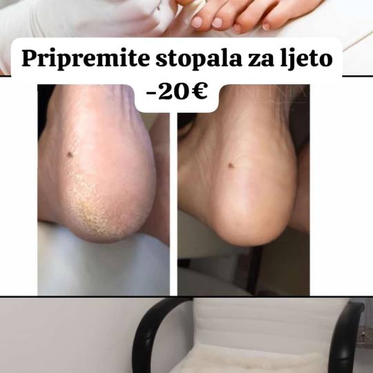 SolGabi #zlatar Estetska pedikura Estetska pedikura