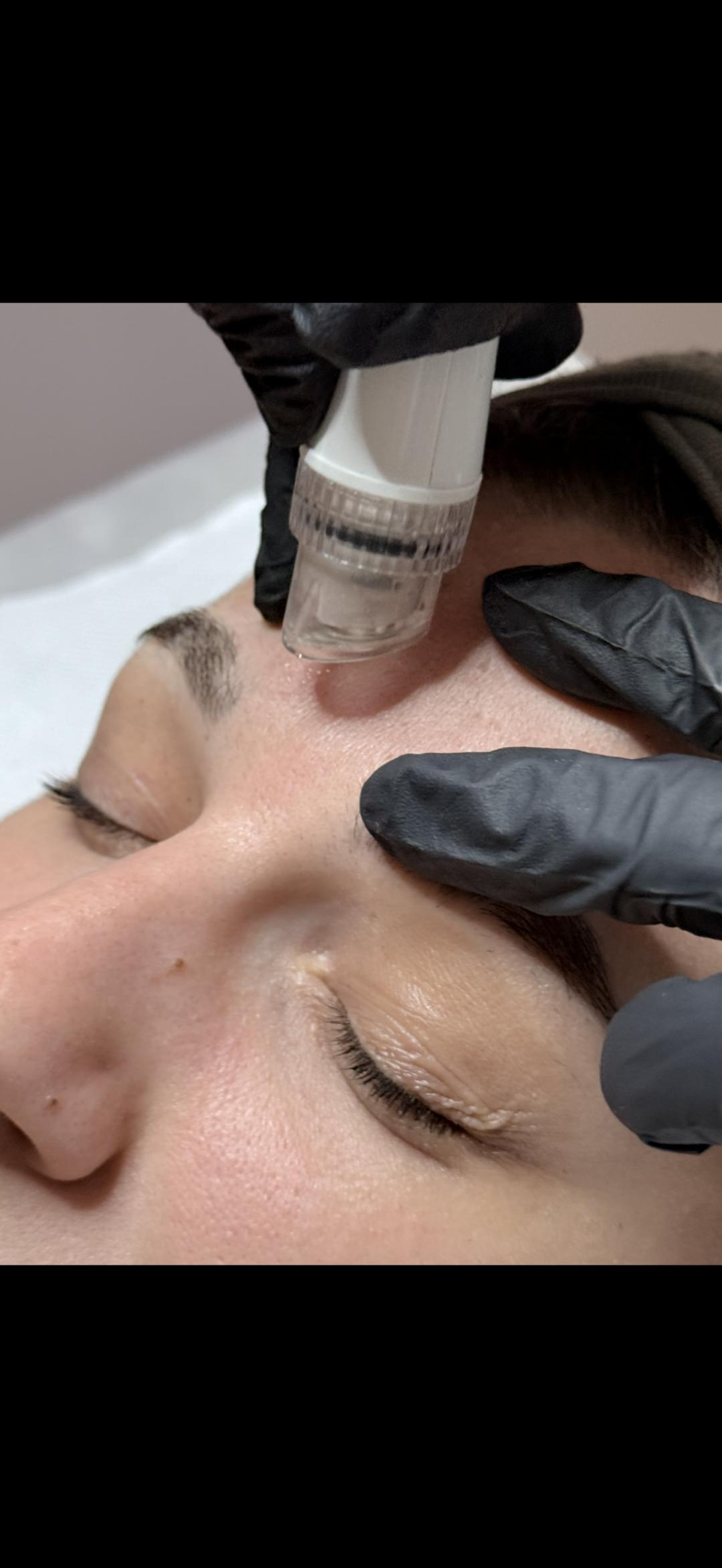 Luxelumíe #zagreb Tretman lica Hydrafacial tretman lica + vrata
