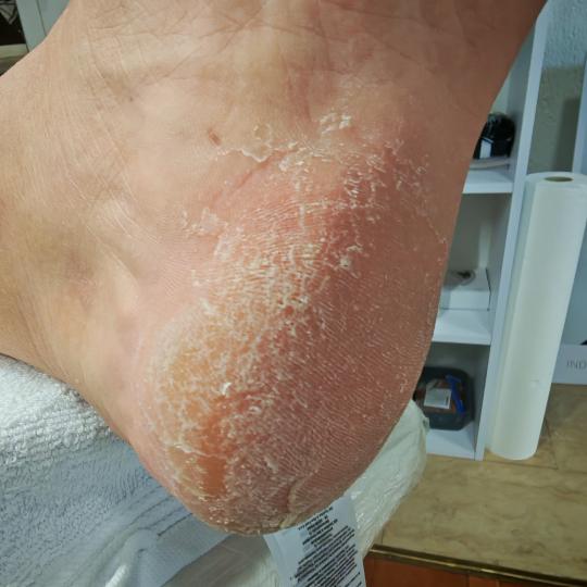 Skin Care Beauty usluga