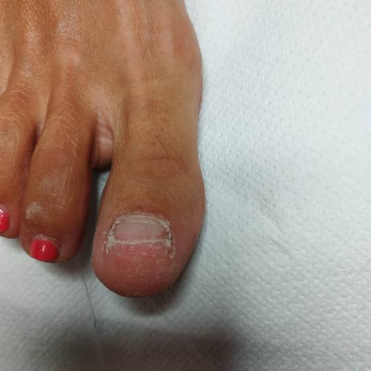 Paint Bar Joy - spas u zadnji čas #zagreb Korekcija noktiju Protetika - 1 nokat Protetika nokta spe