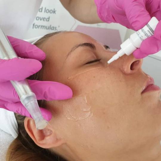 Antiage beauty room Lady Goga #zagreb Tretman lica