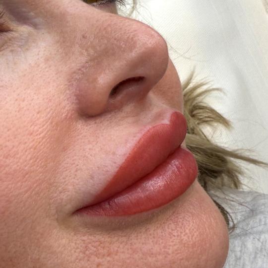SABRINA STRIJA BEAUTY & SPA #zagreb Trajna šminka PMU lips Puno žena nakon filera i dalje ima osje